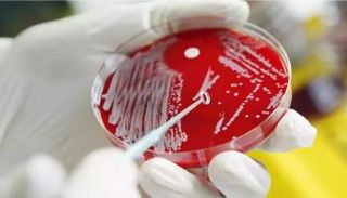 بكتيريا داء الكلم أثناء تحليلها في المعمل