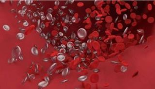 تجلط الدم مصدر خطر يرتبط بالإصابة بـ