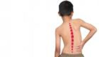 ميل جسم الطفل ينذر بمرض خطير