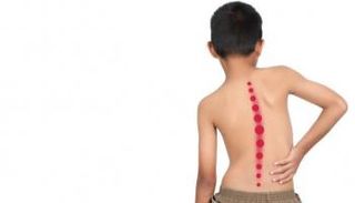 أعراض هذا المرض الخطير تشمل أيضا إمالة الرأس إلى الجانب