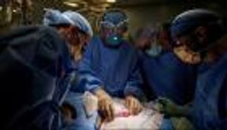 لأول مرة.. زرع كلية خنزير في جسم إنسان (صور)