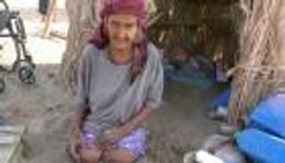 شاهدة على جرائم الحوثي.. "عائدة" تروي قصة بتر ساقيها