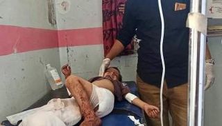أحد الضحايا الأطفال المصابين بهجوم الحوثي المدفعي على تعز