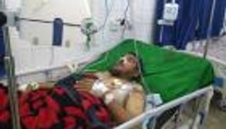 ضحايا تفجير مطار عدن يتحدثون لـ"العين الإخبارية" عن "الليلة السوداء"