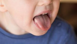  ينبغي العناية الجيدة بالفم لمنع ظهور بثور على اللسان