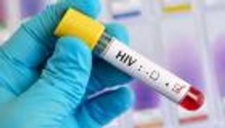 كورونا يفاقم الإيدز.. كارثة في غرب ووسط أفريقيا