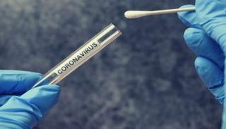 اختبار فيروس كورونا- أرشيفية