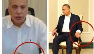 ظهور إصابة الكاظمي على مستوى اليد