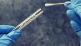 إصابات كورونا عالميا تقترب من 250 مليونا.. واليابان بلا وفيات