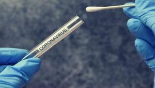 اختبار فيروس كورونا- أرشيفية