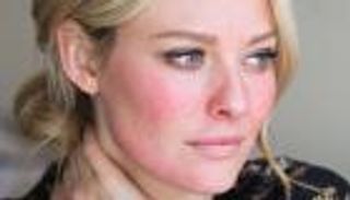 البشرة الحساسة.. علاماتها ونصائح العناية بها