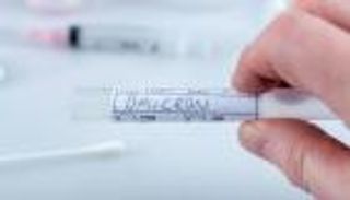 أعراضه "غريبة".. أوميكرون لا يسبب فقدان حاسة التذوق أو الشم 