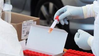 عينات دم للكشف على فيروس أوميكرون