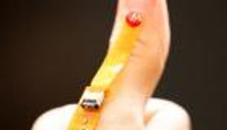 جهاز استشعار يكتشف بكتيريا الجروح قبل تفاقم العدوى