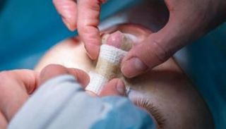 جراحة في الأنف - أرشيفية