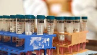 فلسطين ترسل 100 عينة لإسرائيل لفحصها لعدم وجود إمكانيات لرصد 