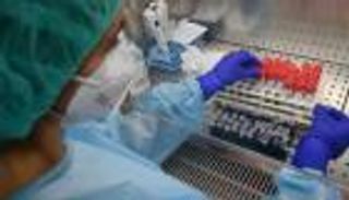 حل مثالي لحماية الخلايا من كورونا.. السر في "الأبتمرات"