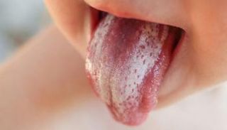 العناية بنظافة الرضيع تفيد في منع فطريات الفم - أرشيفية