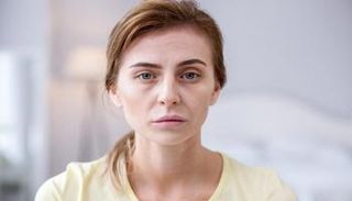 المعاناة من شحوب البشرة تزداد شتاءً- توضيحية