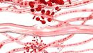 تلف أوعية القلب الدموية.. خطر محتمل لكورونا تكشفه الأشعة السينية