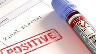 أول إصابة بنقص المناعة البشرية تعود للحرب العالمية الأولى