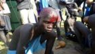 الشلوخ بجنوب السودان.. ممارسة عتيقة يُعاقب عليها القانون