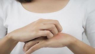 حساسية جلدية- أرشيفية