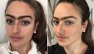 "المرأة الشارب".. دنماركية تتوقف عن إزالة الشعر الزائد: أنهيت عبوديتي للمجتمع