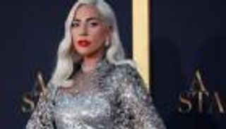 نصف مليون دولار.. مكافأة العثور على كلبي ليدي جاجا