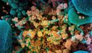 "العلكة".. طريقة فريق بحثي لمنع تكاثر كورونا