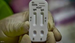 جهاز فحص الأجسام المضادة لكوفيد -19