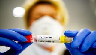 اختبار فيروس كورونا - أرشيفية