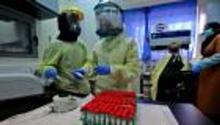 22 وفاة و2309 إصابات جديدة بكورونا في فلسطين