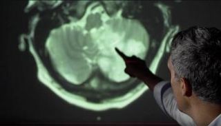 فحوصات الرئة يمكنها التنبؤ بمن سيواجه مشاكل عصبية محتملة، جراء الإصابة بكورونا