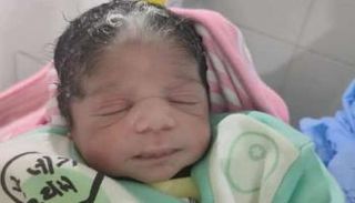 الطفلة المولودة بخصلة شعر أبيض