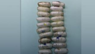 شحنة الكوكايين بعد استخراجها من بطن المسافر