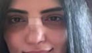 حورية فرغلي تستعيد حاسة الشم بعد عمليتين.. وتكشف تفاصيل صورة مسربة