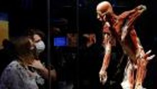 معرض فني لجثث بشرية محفوظة.. صور لأصحاب القلوب القوية فقط