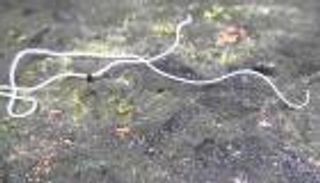 فيديو.. استخراج دودة طولها 18 متراً من أمعاء رجل