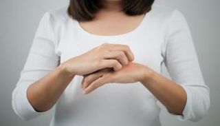 حساسية النيكل تسبب طفح جلدي- أرشيفية