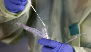 اختبار فيروس كورونا - أرشيفية