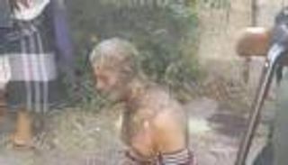 ظلم الحوثي يكوي اليمنيين.. معاق يحرق جسده لنصرة نجله