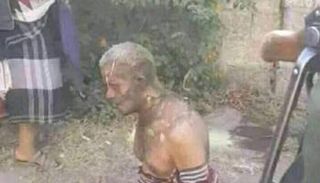 المعاق اليمني أحمد يحيى البعداني 