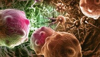 خلايا سرطانية