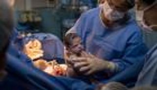 دراسة: مواليد "القيصرية" أكثر عُرضة للإصابة بالحساسية