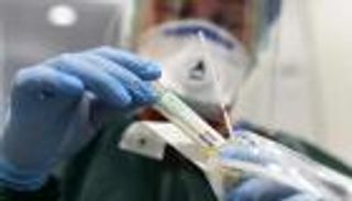 لقاح كورونا والممرضة الألمانية.. التحقيق في جرم محتمل