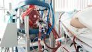 أجهزة "دعم الحياة" تحارب أعراض كورونا الخطيرة