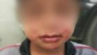 ضربه بالخرطوم.. موجة استنكار في لبنان لتعذيب أب سوري لطفله