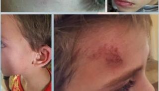 الطفل المعنّف