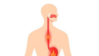 نصائح لمرضى ارتجاع المريء في رمضان